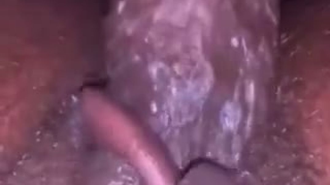 Closeup
